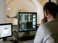 Lung cancer screening ‘will save lives’